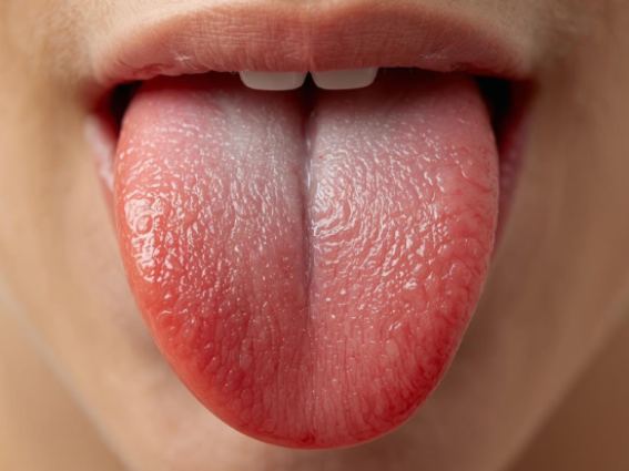Lingua bianca: cause, segnali da osservare e corretta igiene orale